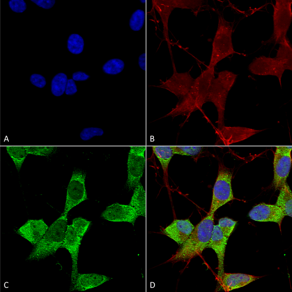 Immunocytochemistry/Immunofluorescence analysis using Mouse Anti-TASK1 Potassium Channel Monoclonal Antibody, Clone N374/48 (STMA00160). Tissue: Neuroblastoma cells (SH-SY5Y). Species: Human. Fixation: 4% PFA for 15 min. Primary Antibody: Mouse Anti-TASK1 Potassium Channel Monoclonal Antibody (STMA00160) at 1:50 for overnight at 4°C with slow rocking. Secondary Antibody: AlexaFluor 488 at 1:1000 for 1 hour at RT.