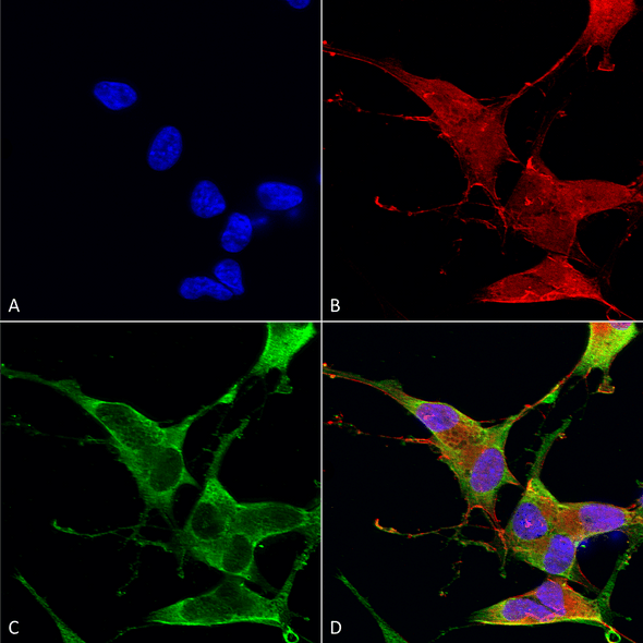 Immunocytochemistry/Immunofluorescence analysis using Mouse Anti-Ankyrin R Monoclonal Antibody, Clone N388A/10 (STMA00167). Tissue: Neuroblastoma cells (SH-SY5Y). Species: Human. Fixation: 4% PFA for 15 min. Primary Antibody: Mouse Anti-Ankyrin R Monoclonal Antibody (STMA00167) at 1:100 for overnight at 4°C with slow rocking. Secondary Antibody: AlexaFluor 488 at 1:1000 for 1 hour at RT.