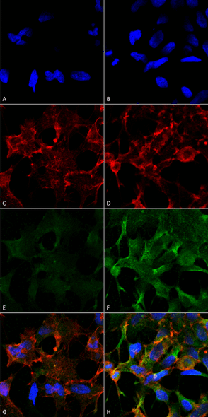 Immunocytochemistry/Immunofluorescence analysis using Mouse Anti-Acrolein Monoclonal Antibody, Clone 2H2 (STMA00177). Tissue: Embryonic kidney epithelial cell line (HEK293). Species: Human. Fixation: 5% Formaldehyde for 5 min. Primary Antibody: Mouse Anti-Acrolein Monoclonal Antibody (STMA00177) at 1:50 for 30-60 min at RT. Secondary Antibody: Goat Anti-Mouse Alexa Fluor 488 at 1:1500 for 30-60 min at RT.