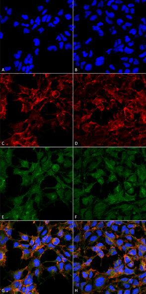Immunocytochemistry/Immunofluorescence analysis using Mouse Anti-Malondialdehyde Monoclonal Antibody, Clone 6H6 (STMA00184). Tissue: Embryonic kidney epithelial cell line (HEK293). Species: Human. Fixation: 5% Formaldehyde for 5 min. Primary Antibody: Mouse Anti-Malondialdehyde Monoclonal Antibody (STMA00184) at 1:50 for 30-60 min at RT. Secondary Antibody: Goat Anti-Mouse Alexa Fluor 488 at 1:1500 for 30-60 min at RT.
