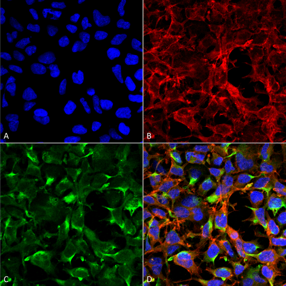 Immunocytochemistry/Immunofluorescence analysis using Mouse Anti-Dityrosine Monoclonal Antibody, Clone 7D4 (STMA00188). Tissue: Embryonic kidney cells (HEK293) cultured overnight with 50 µM H2O2. Species: Human. Fixation: 5% Formaldehyde for 5 min. Primary Antibody: Mouse Anti-Dityrosine Monoclonal Antibody (STMA00188) at 1:50 for 30-60 min at RT. Secondary Antibody: Goat Anti-Mouse Alexa Fluor 488 at 1:1500 for 30-60 min at RT.