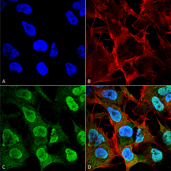 Immunocytochemistry/Immunofluorescence analysis using Mouse Anti-Alpha Synuclein Monoclonal Antibody, Clone 4F1 (STMA00194). Tissue: Neuroblastoma cell line (SK-N-BE). Species: Human. Fixation: 4% Formaldehyde for 15 min at RT. Primary Antibody: Mouse Anti-Alpha Synuclein Monoclonal Antibody (STMA00194) at 1:100 for 60 min at RT. Secondary Antibody: Goat Anti-Mouse ATTO 488 at 1:200 for 60 min at RT.