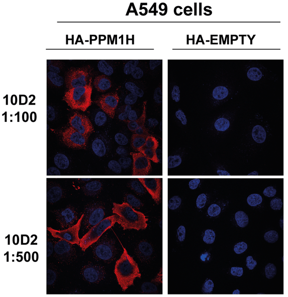 Immunocytochemistry/Immunofluorescence analysis using Mouse Anti-PPM1H Monoclonal Antibody, Clone 10D2 (STMA00221). Tissue: Alveolar Basal Epithelial cells (A549). Species: Hu, Ms, Rt. Primary Antibody: Mouse Anti-PPM1H Monoclonal Antibody (STMA00221) at 1:1000 for 1 hour at RT. Secondary Antibody: Alexa Fluor 594 Donkey anti mouse secondary diluted in 0.2% BSA + 0.02% sodium azide in PBS at 1:1000 for 1 hour at RT.
