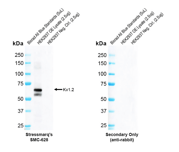Western blot analysis with Rabbit Anti-Kv1.2 Monoclonal Antibody, Clone C25 (STMA00232) showing detection of Human Kv1.2 protein in a transient over-expression (OE) lysate (OriGene LY401550). Block: 2% skim milk + 2% BSA for 1 hour at RT. Primary Antibody: Rabbit Anti-Human Kv1.2 Recombinant Monoclonal [C25] (STMA00232) at 1:10000 for 2 hours at RT. Secondary Antibody: Goat anti-Rabbit IgG-HRP (H&L) at 1:5000 for 1 hour at RT.