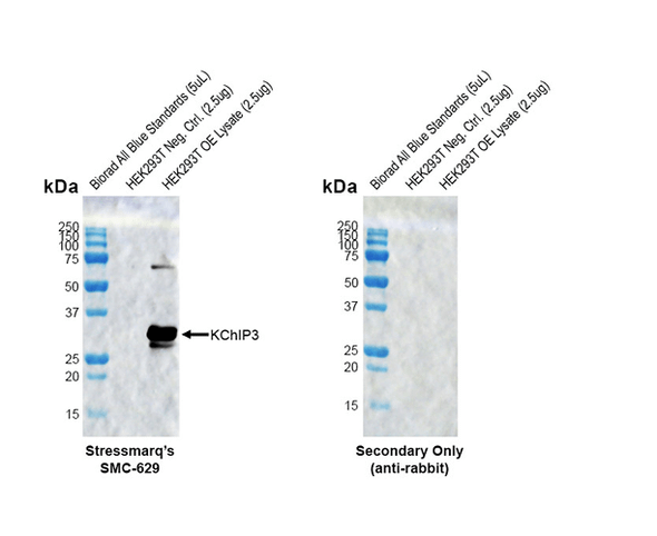 Western blot analysis with Rabbit Anti-Rat KChIP3 Monoclonal Antibody, Clone X12 (STMA00233) showing detection of Human KChIP3 protein in a transient over-expression lysate (OriGene LY415545). Block: 2% skim milk + 2% BSA for 1 hour at RT. Primary Antibody: Rabbit Anti-Rat KChIP3 Recombinant Monoclonal [X12] (STMA00233) at 1:1000 for 2 hours at RT. Secondary Antibody: Goat anti-rabbit IgG-HRP (H&L) at 1:5000 for 1 hour at RT.