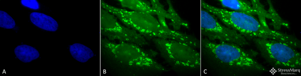 Immunocytochemistry/Immunofluorescence analysis using Rabbit Anti-Hsp60 Polyclonal Antibody (STPA00004). Tissue: Heat Shocked Cervical cancer cell line (HeLa). Species: Human. Fixation: 2% Formaldehyde for 20 min at RT. Primary Antibody: Rabbit Anti-Hsp60 Polyclonal Antibody (STPA00004) at 1:100 for 12 hours at 4°C. Secondary Antibody: FITC Goat Anti-Rabbit (green) at 1:200 for 2 hours at RT.