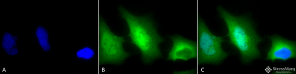 Immunocytochemistry/Immunofluorescence analysis using Rabbit Anti-SOD1 (Cu/Zn) Polyclonal Antibody (STPA00011). Tissue: Cervical cancer cell line (HeLa). Species: Human. Fixation: 2% Formaldehyde for 20 min at RT. Primary Antibody: Rabbit Anti-SOD1 (Cu/Zn) Polyclonal Antibody (STPA00011) at 1:120 for 12 hours at 4°C. Secondary Antibody: FITC Goat Anti-Rabbit (green) at 1:200 for 2 hours at RT.