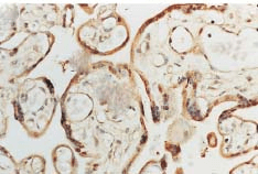 Immunohistochemistry analysis using Rabbit Anti-SOD1 (Cu/Zn) Polyclonal Antibody (STPA00012). Tissue: Placenta. Species: Human. Primary Antibody: Rabbit Anti-SOD1 (Cu/Zn) Polyclonal Antibody (STPA00012) at 1:100. Courtesy of: Courtesy of Joan Telfer, University of Glasgow.