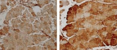 Immunohistochemistry analysis using Rabbit Anti-SOD2 (Mn) Polyclonal Antibody (STPA00014). Tissue: muscle fibres. Species: Rat. Primary Antibody: Rabbit Anti-SOD2 (Mn) Polyclonal Antibody (STPA00014) at 1:100. Left: Untreated, Right: treated with 3mmol*kg-1 NAC. Courtesy of: E. Barreiro, IMIM, Spain.