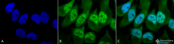 Immunocytochemistry/Immunofluorescence analysis using Rabbit Anti-Phosphothreonine Polyclonal Antibody (STPA00022). Tissue: Cervical cancer cell line (HeLa). Species: Human. Fixation: 2% Formaldehyde for 20 min at RT. Primary Antibody: Rabbit Anti-Phosphothreonine Polyclonal Antibody (STPA00022) at 1:60 for 12 hours at 4°C. Secondary Antibody: FITC Goat Anti-Rabbit (green) at 1:200 for 2 hours at RT.