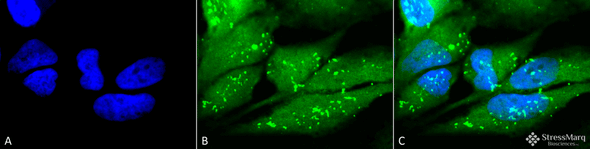 Immunocytochemistry/Immunofluorescence analysis using Rabbit Anti-p38 Polyclonal Antibody (STPA00027). Tissue: Cervical cancer cell line (HeLa). Species: Human. Fixation: 2% Formaldehyde for 20 min at RT. Primary Antibody: Rabbit Anti-p38 Polyclonal Antibody (STPA00027) at 1:100 for 12 hours at 4°C. Secondary Antibody: FITC Goat Anti-Rabbit (green) at 1:200 for 2 hours at RT. Counterstain: DAPI (blue) nuclear stain at 1:40000 for 2 hours at RT.