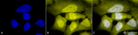 Immunocytochemistry/Immunofluorescence analysis using Rabbit Anti-Phosphoserine Polyclonal Antibody (STPA00021). Tissue: Cervical cancer cell line (HeLa). Species: Human. Fixation: 2% Formaldehyde for 20 min at RT. Primary Antibody: Rabbit Anti-Phosphoserine Polyclonal Antibody (STPA00021) at 1:50 for 12 hours at 4°C. Secondary Antibody: R-PE Goat Anti-Rabbit (yellow) at 1:200 for 2 hours at RT.