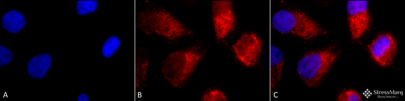 Immunocytochemistry/Immunofluorescence analysis using Rabbit Anti-TNF-R1 Polyclonal Antibody (STPA00026). Tissue: Cervical cancer cell line (HeLa). Species: Human. Fixation: 2% Formaldehyde for 20 min at RT. Primary Antibody: Rabbit Anti-TNF-R1 Polyclonal Antibody (STPA00026) at 1:100 for 12 hours at 4°C. Secondary Antibody: APC Goat Anti-Rabbit (red) at 1:200 for 2 hours at RT.