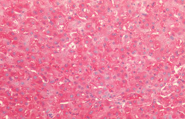 Immunohistochemistry analysis using Rabbit Anti-HSP60 Polyclonal Antibody (STPA00033). Tissue: Liver. Species: Human. Fixation: Formalin fixed paraffin-embedded. Primary Antibody: Rabbit Anti-HSP60 Polyclonal Antibody (STPA00033).