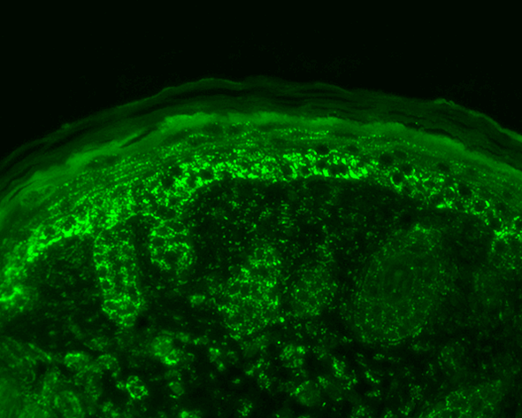 Immunohistochemistry analysis using Rabbit Anti-Cpn10 Polyclonal Antibody (STPA00036). Tissue: backskin. Species: Mouse. Fixation: Bouin's Fixative Solution. Primary Antibody: Rabbit Anti-Cpn10 Polyclonal Antibody (STPA00036) at 1:100 for 1 hour at RT. Secondary Antibody: FITC Goat Anti-Rabbit (green) at 1:50 for 1 hour at RT. Localization: Strong basal layer punctate staining in the cytoplasm, weakens as it ascends to upper epidermis.
