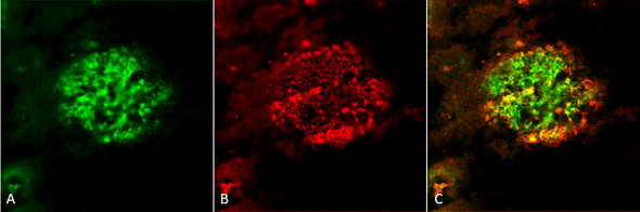 Immunohistochemistry analysis using Rabbit Anti-Amyloid Fibrils (OC) Polyclonal Antibody (STPA00056). Tissue: Alzheimer's Disease brain. Species: Human. Fixation: Formalin fixed. Primary Antibody: Rabbit Anti-Amyloid Fibrils (OC) Polyclonal Antibody (STPA00056) at 1:5000. Secondary Antibody: Goat Anti-Rabbit ATTO 488 (green). Localization: Plaque. (A) Amyloid Fibril (OC) Antibody (STPA00056). (B) Amyloid Oligomer (A11) Antibody (STPA00055).