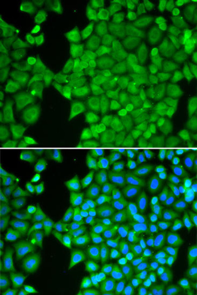 Anti-CA3 Antibody (CAB13473)