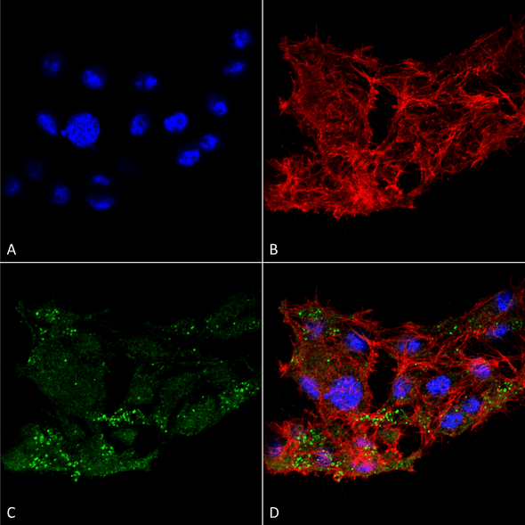 Immunocytochemistry/Immunofluorescence analysis using Rabbit Anti-ATG7 Polyclonal Antibody (STPA00060). Tissue: Colon carcinoma cell line (RKO). Species: Human. Fixation: 4% Formaldehyde for 15 min at RT. Primary Antibody: Rabbit Anti-ATG7 Polyclonal Antibody (STPA00060) at 1:100 for 60 min at RT. Secondary Antibody: Goat Anti-Rabbit ATTO 488 at 1:100 for 60 min at RT.