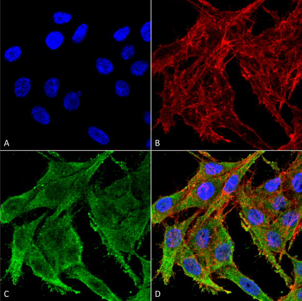Immunocytochemistry/Immunofluorescence analysis using Rabbit Anti-Kir4.1 Polyclonal Antibody (STPA00071). Tissue: Colon carcinoma cell line (RKO). Species: Human. Fixation: 4% Formaldehyde for 15 min at RT. Primary Antibody: Rabbit Anti-Kir4.1 Polyclonal Antibody (STPA00071) at 1:100 for 60 min at RT. Secondary Antibody: Goat Anti-Rabbit ATTO 488 at 1:100 for 60 min at RT.