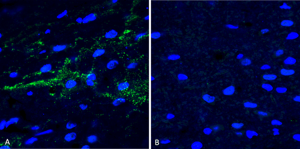 Immunohistochemistry analysis using Rabbit Anti-Alpha Synuclein (pSer129) Polyclonal Antibody (STPA00078). Tissue: Free floating brain sections. Species: Mouse. Fixation: PFA. Primary Antibody: Rabbit Anti-Alpha Synuclein (pSer129) Polyclonal Antibody (STPA00078) at 1:500 for overnight at 4C with gentle agitation. Counterstain: Hoechst. Magnification: 63X. A) Right hemisphere (striatum) injected with alpha synuclein AAV vector. B) Control.