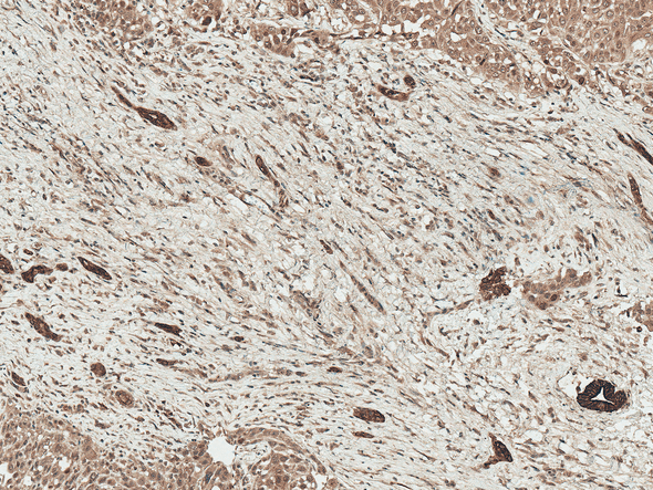 Immunohistochemistry analysis using Rabbit Anti-LRP1 Polyclonal Antibody (STPA00084). Tissue: Liver. Species: Human. Fixation: Formalin Fixed Paraffin-Embedded. Primary Antibody: Rabbit Anti-LRP1 Polyclonal Antibody (STPA00084) at 1:50 for 30 min at RT. Counterstain: Hematoxylin. Magnification: 10X. HRP-DAB Detection.