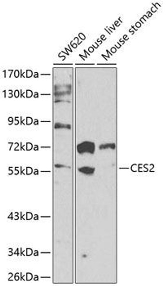 Anti-CES2 Antibody (CAB13640)