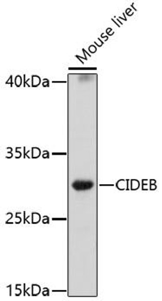 Anti-CIDEB Antibody (CAB17141)