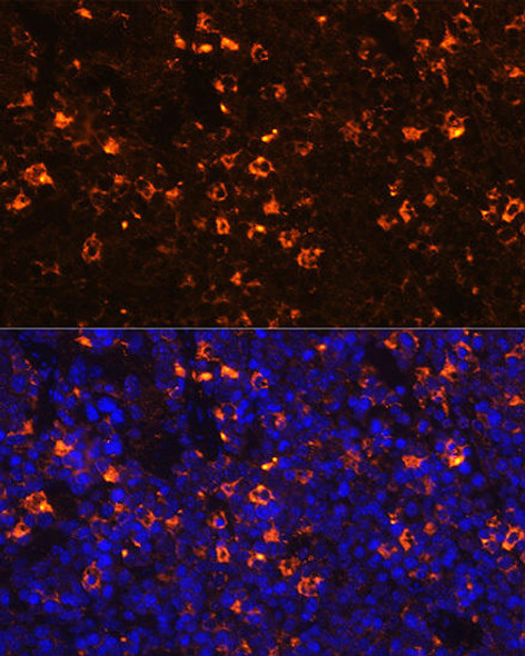 Anti-CLEC4D Antibody (CAB2697)