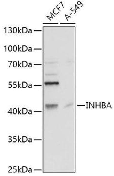 Anti-INHBA Antibody (CAB5837)