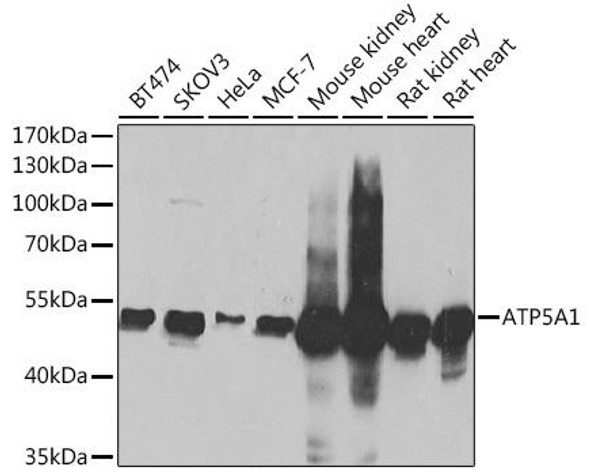 Anti-ATP5A1 Antibody (CAB5884)