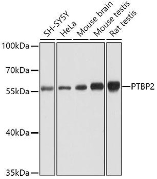 Anti-PTBP2 Antibody (CAB6054)