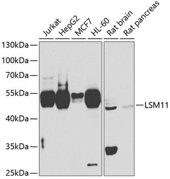 Anti-LSM11 Antibody (CAB7516)