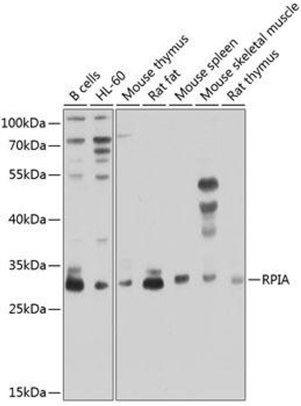 Anti-RPIA Antibody (CAB8867)