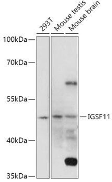 Anti-IGSF11 Antibody (CAB17837)