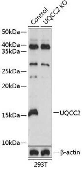 Anti-UQCC2 Antibody (CAB19955)[KO Validated]