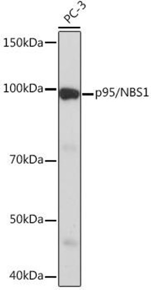 Anti-p95/NBS1 Antibody (CAB4197)