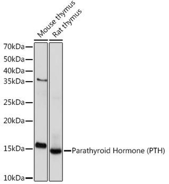 Anti-Parathyroid Hormone (PTH) Antibody (CAB9704)