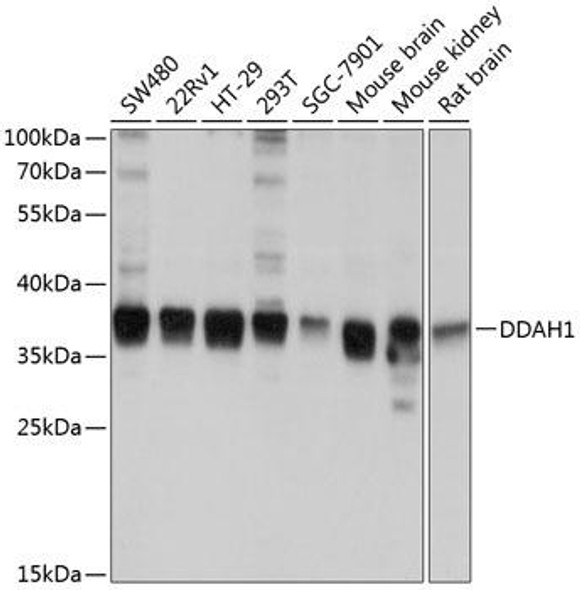 Anti-DDAH1 Antibody (CAB10295)