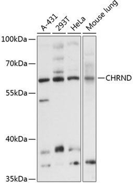 Anti-CHRND Antibody (CAB10467)
