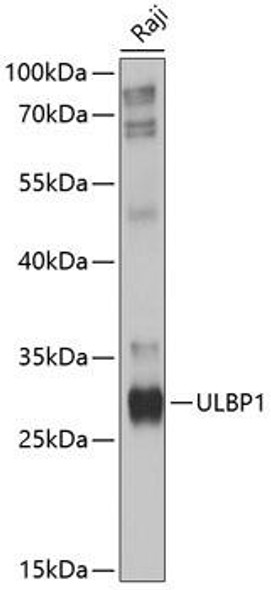 Anti-ULBP1 Antibody (CAB10483)