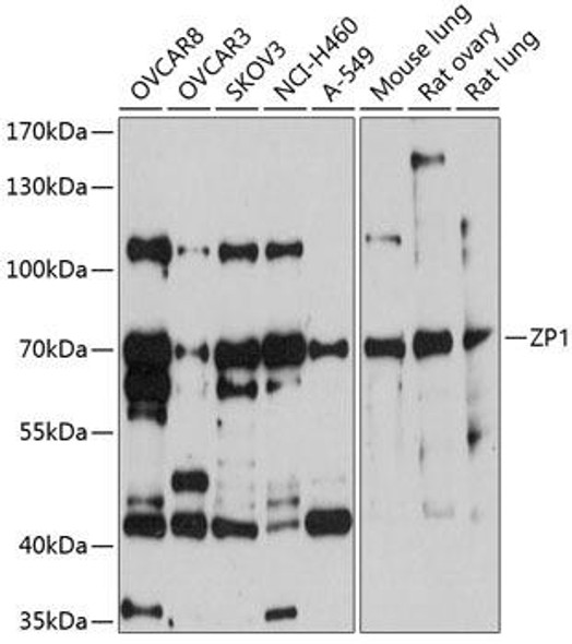Anti-ZP1 Antibody (CAB10776)