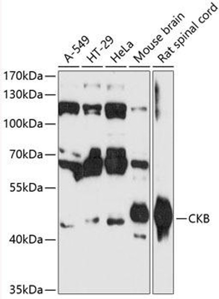 Anti-CKB Antibody (CAB12631)