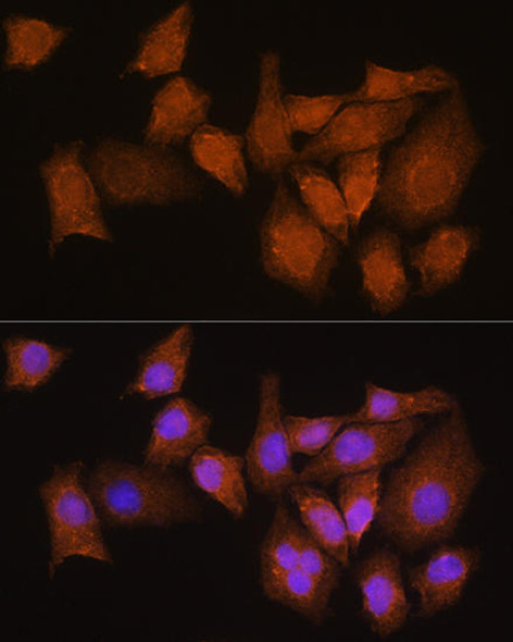 Anti-NMNAT3 Antibody (CAB14465)