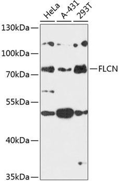 Anti-FLCN Antibody (CAB14521)