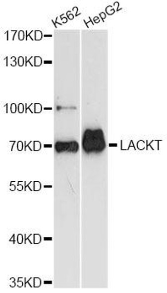 Anti-ASH2L Antibody (CAB14543)