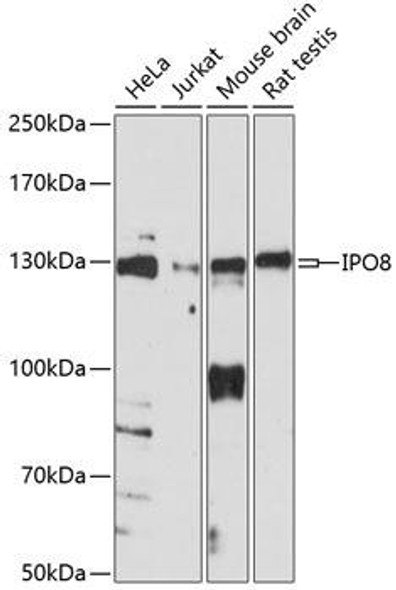 Anti-IPO8 Antibody (CAB14679)