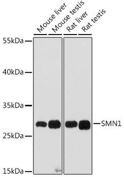 Anti-SMN1 Antibody (CAB16246)