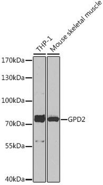 Anti-GPD2 Antibody (CAB16378)