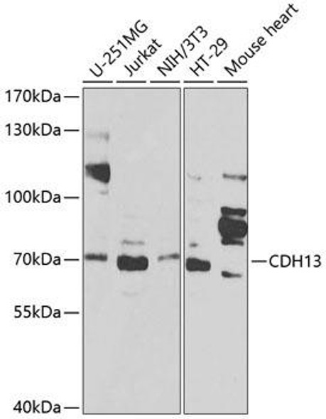Anti-CDH13 Antibody (CAB1761)