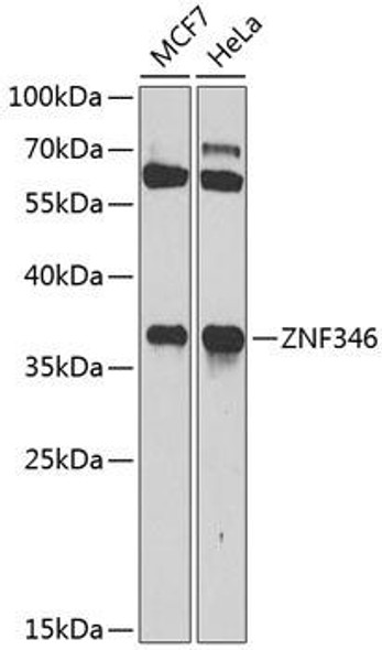 Anti-ZNF346 Antibody (CAB3397)